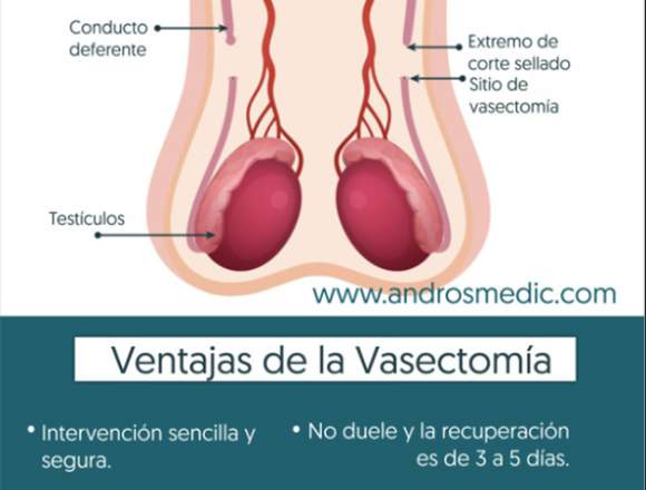 Androsmedic Vasectomía 