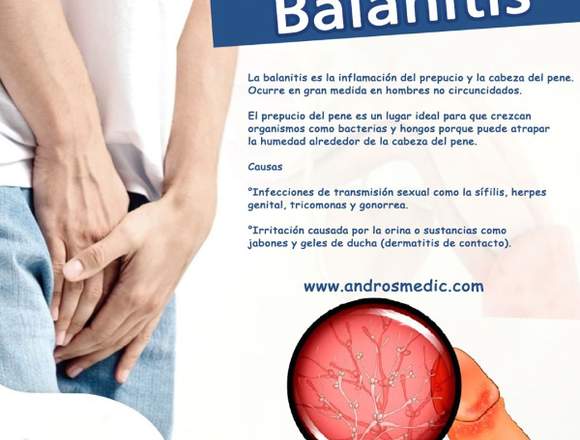 Androsmedic  Balanitis