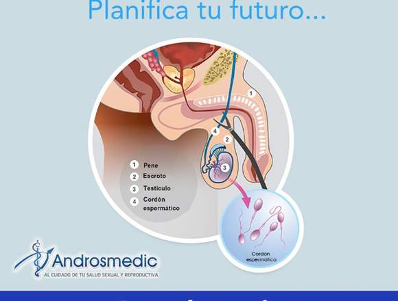 Androsmedic VASECTOMÍA 