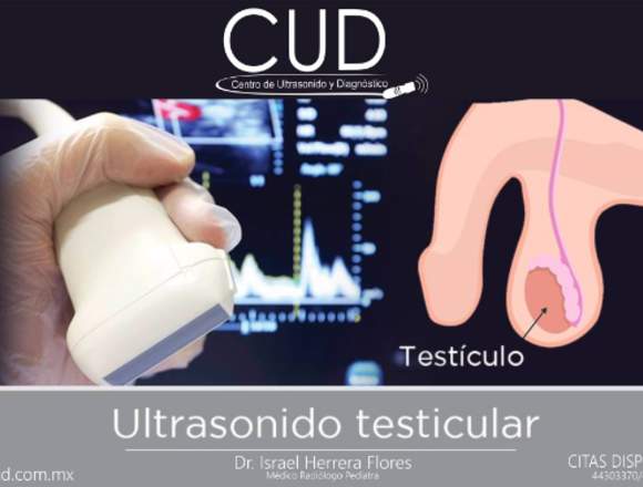 CUD ULTRASONIDO TESTICULAR