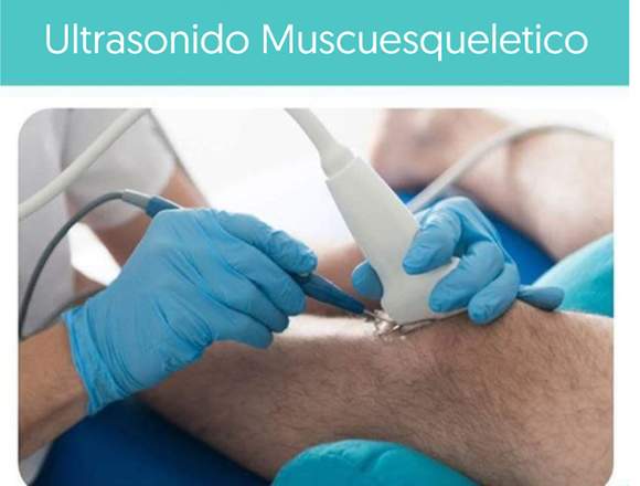 CUD ULTRASONIDO Muscuesqueletico