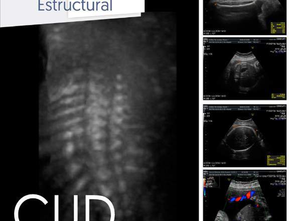 CUD Centro de ultrasonidos y Diagnósticos