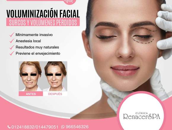 VOLUMINIZACIÓN FACIAL-Clínica Renacer SPA