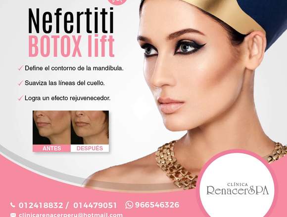 Nefertiti BOTOX lift- La Clínica RenacerSPA