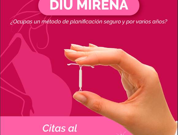 Diu Mirena - Ginecologia Gynemer