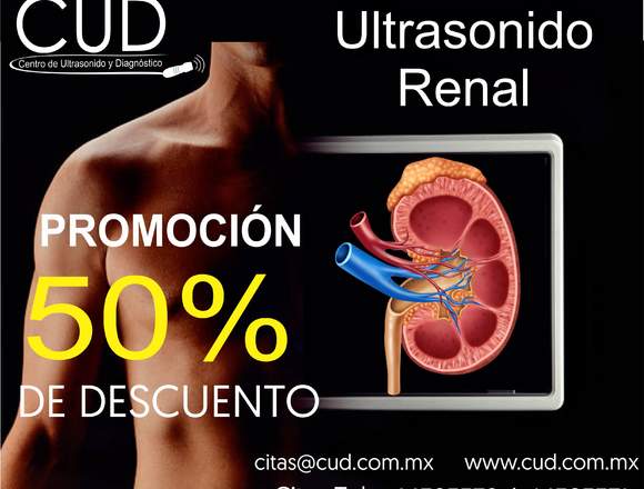 CUD PROMOCIONES......