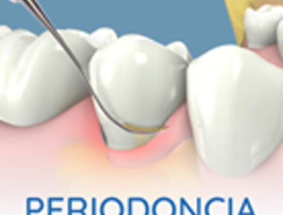 Periodoncia  Loja Stoma Dental Studio