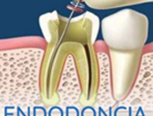 Endodoncia Loja Stoma Dental Studio