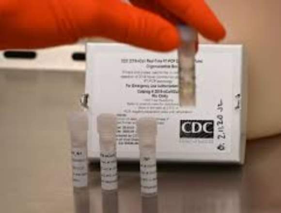 KITS DE PRUEBA PARA COVID19 CORONAVIRUS