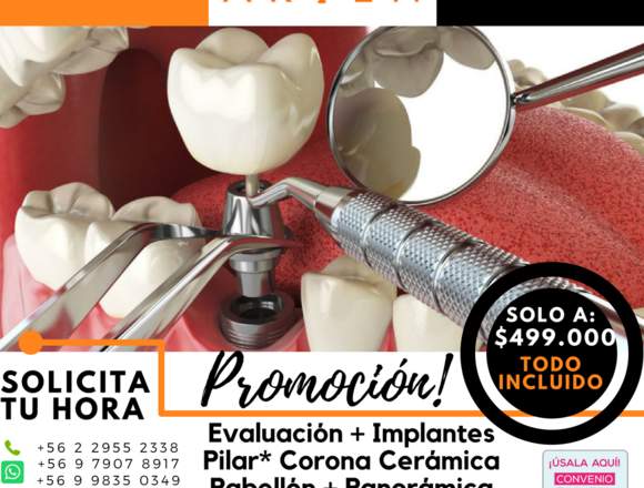 PROMOCION IMPLANTES DENTALES