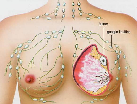 Contra el Cancer Como protegerse Libro Digital