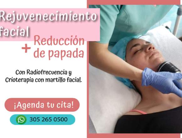  Rejuvenecimiento facial + Reducción de papada