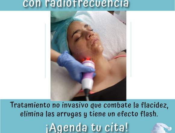 Rejuvenecimiento facial con Radiofrecuencia: