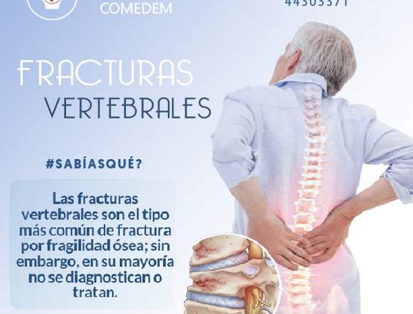 ¿Fracturas Vertebrales? 