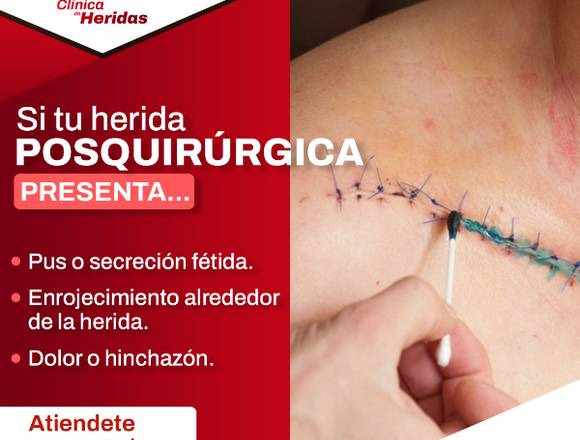 Curación para heridas