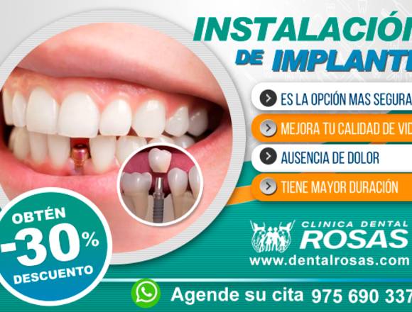 DENTAL ROSAS – CLÍNICA DENTAL EN SJL