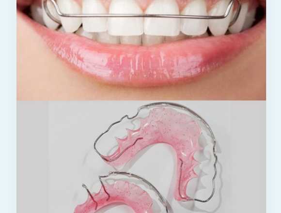 Retenedores de ortodoncia a domicilio 