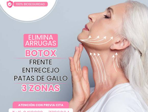 Elimina arrugas con botox