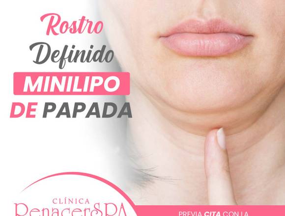 Lipolaser de papada  Reduce la grasa de la papa