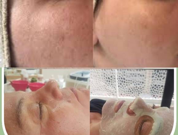 Lipieza Facial Salon Carolinas