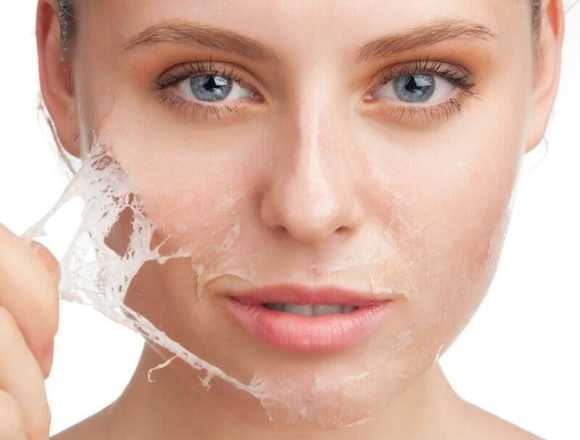 Peeling facial en Salones Carolinas