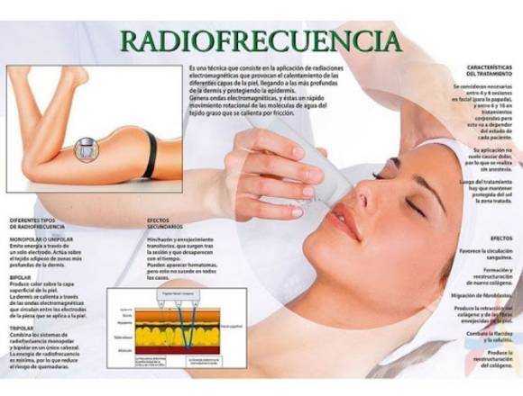 Radiofrecuencia facial en Salón Carolina’s