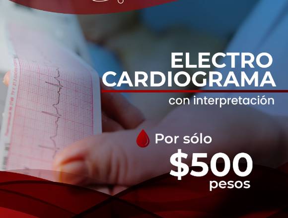 electrocardiograma con interpretación