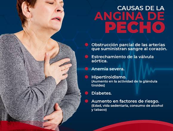 Causas de Angina de pecho