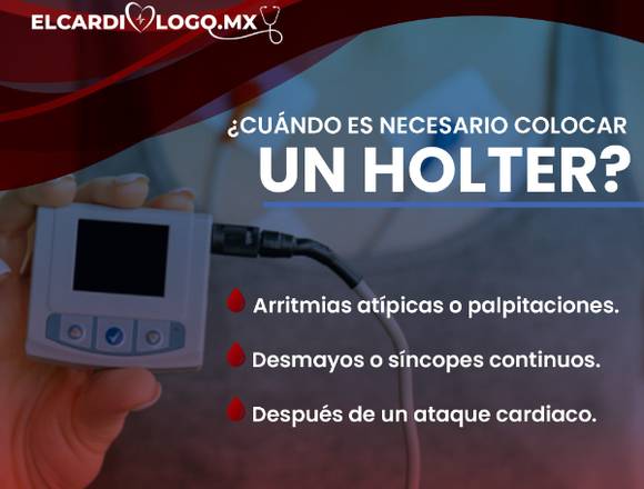 ¿Cuándo es necesario un holter?