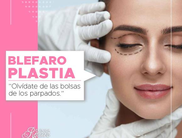 Blefaroplastia Clinica Renacer