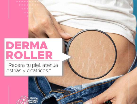 Dermaroller Clinica Renacer