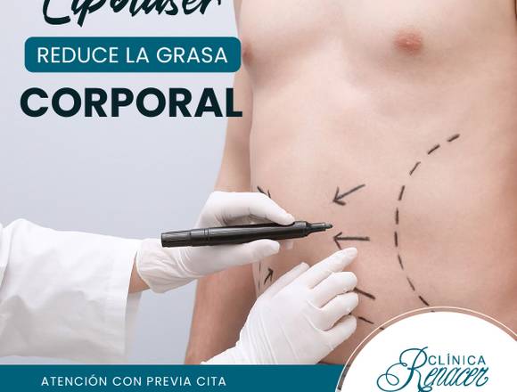 Lipolaser reduce la grasa corporal