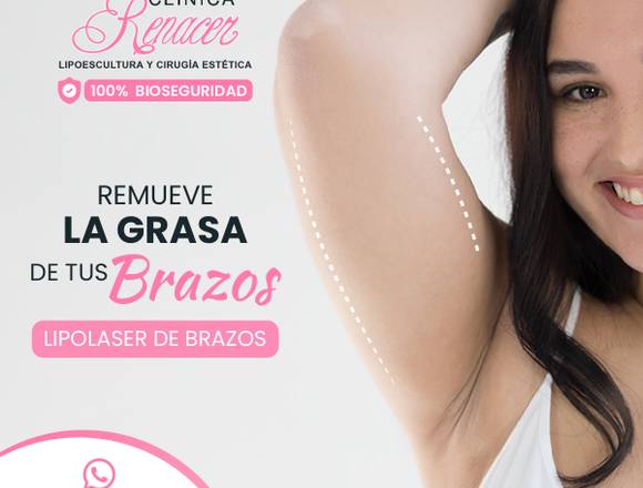 Remueve la grasa de tus brazos