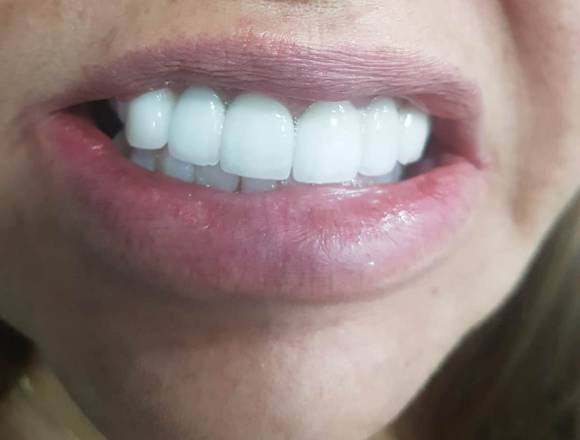 Unidad Estética Dental ODONTOFLEXY