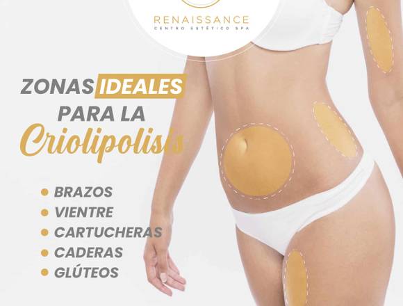 Criolipolisis: Zonas a aplicar