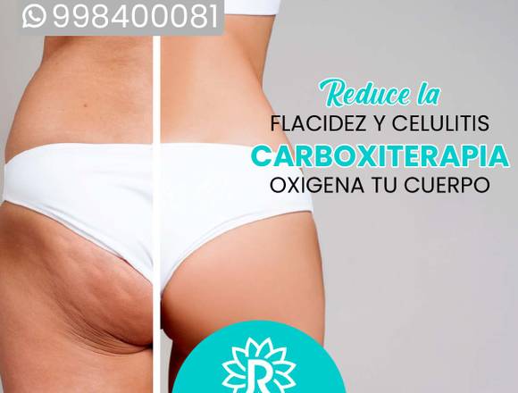 Elimina grasa abdominal carboxiterapia