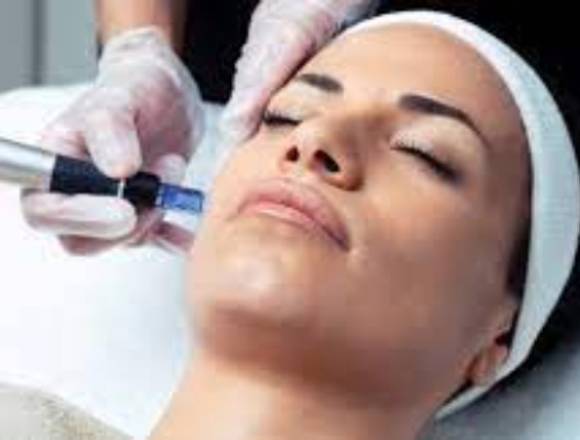 powermix y dermapen en salon carolina's