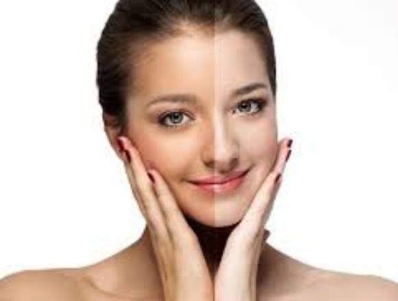 Peeling facial en salon carolina´s