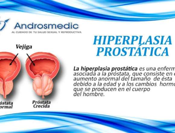 Androsmedic Hiperplasia Prostática 