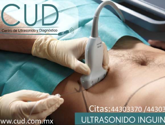 CUD ultrasonido inguinal 