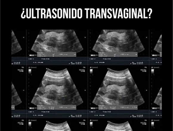 CUD Ultrasonidos Transvaginal 