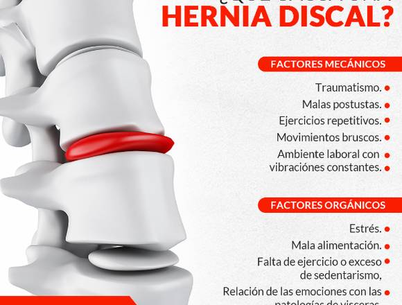 No vivas con hernia discal