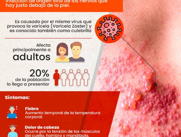 No sufras por el herpes zóster