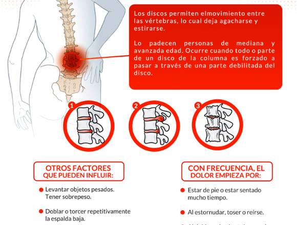 No vivas con hernia discal