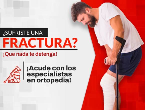 ¿Sufriste una fractura?