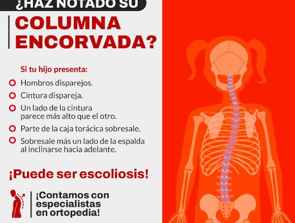 ¿Haz notado tu columna encorvada?