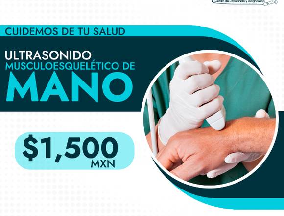 Ultrasonido musculoesquelético de mano 