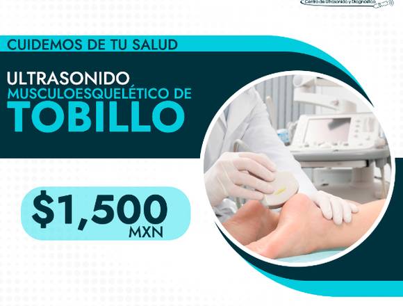 Ultrasonido musculoesquelético tobillo 