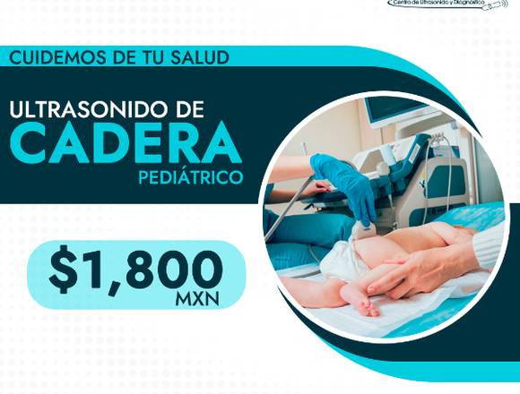 Ultrasonido de cadera pediatrico