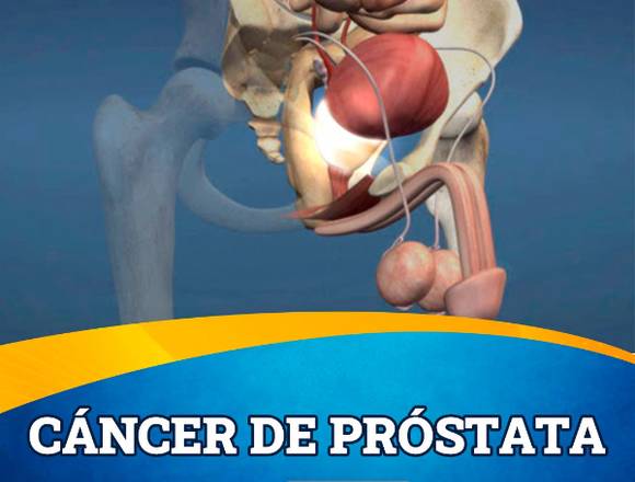 Cáncer de Próstata  